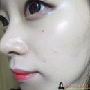 아임스킨