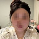 맑은린 | [윤곽관리] 광주 월계동 윤곽관리 맛집 '맑은린에스테틱'