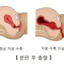 수축 이미지