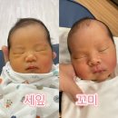 새힘병원 | 대구 효성병원 경산모 제왕절개 4일차 후기 (황달이슈)