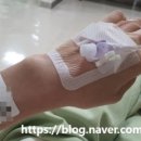 파티마약국 | 담낭 제거 수술(2) / 대구 파티마병원, 입원실료, 수술비용 등