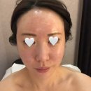봉위치킨 | 잠실피부관리 추천｜열감·붓기 진정 1:1 맞춤 피비스킨 에스테틱 솔직 후기