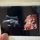 닥터황여성의원 | 대전 유성온천역 초음파 맛집 닥터황 여성의원 세컨병원으로 다니기