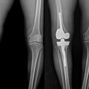 연세사랑병원 이미지