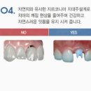 바른사람치과의원 네이버블로그