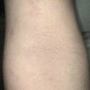 아토윌사랑한의원 이미지