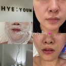 윰 에스테틱 | 상현동피부관리 샵 에스테틱 혜:윰 인텐시브 케어로 무거운 승모근 안녕