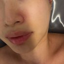 지에스25노형드림점 | 모현동 피부관리 추천 올가드림뷰티 모현송학점 비타민초음파관리 상세후기