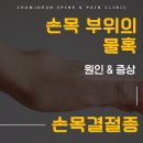 김천참좋은마취통증의학과의원 | 김천마취통증의학과, 손목 주변 볼록하고 말랑한 혹, 원인은? &#39;손목결절종&#39;