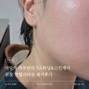 에스에이(SA)왁싱 스킨케어 | 야당역 피부관리 SA왁싱&amp;스킨케어 쥐젖 편평사마귀 제거후기