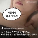 하대동320 | 진주바디관리 강선뷰티동안연구소 : 승모근 파괴하는 곳