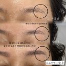 후후브로