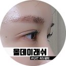 올데이래쉬