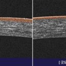 굿모닝백이안과의원 이미지
