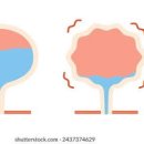 소변이 자주 마려움 소변이 자주 마려운 이유 과도한 배뇨 원인 빈뇨원인 좋은음식 나쁜음식 이미지