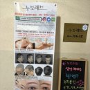 누보 | [의정부] 의정부 피부관리 잘하는곳 누보레브 솔직후기