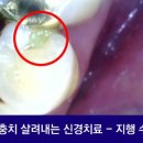 지행수치과의원 네이버블로그