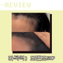 라인1차 | 회사 퇴근길에 들른 마곡두피관리, 모멘즈SMP 여성동안헤어라인 1차 후기_마곡탈모