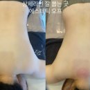 애프터 오프 이미지