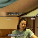 참을수 없는 고통 -CRPS 증후군 이미지