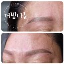 더빛나눈