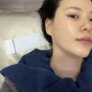 두피채움연구소 | 동탄피부관리 :: 채움피부연구소 k샤이닝 후기