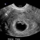 엠여성의원 이미지