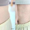 아름화