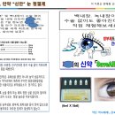 세이보 안약 “신안” 눈 청결제 이미지