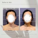 아름다움을꿈꾸는곳 피부관리