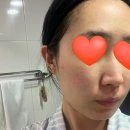 강인유통 | 클렌징밤 추천! 오닝바이브 파인샷 엑소좀 멜팅 그라인딩 클렌징밤 사용 후기