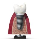 서울필치과의원 이미지