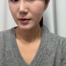 페이스 | 튠페이스 후기 비포 에프터