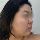 테라피+12 | 논현 에스테틱 온다르 내돈내산 후기｜하이푸·윤곽관리·산소테라피 12회 직접 받아본 솔직 후기