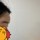 [모제림 성형외과의원] 절개/비절개, 절개 2900모 상담후기, 수술당일후기