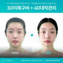 이목구비화장품 | 대구신부관리 고운빛깔에스테틱대구점 예신을 위한 웨딩케어 3D이목구비 솔직후기