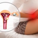 렛미PT&필라테스 스튜디오 이미지