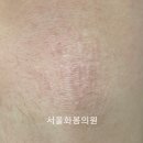 서울화봄의원 이미지