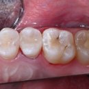 박재필치과의원 | 큐레이 (Qray) 를 이용하여 충치 검진을 받으세요!