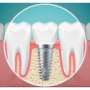 오름치과의원 이미지