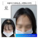 비앤에스