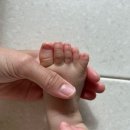 세븐일레븐 대구K병원점 | 대구 더블유병원(w병원) 다지증, 합지증 수술 입원 후기 (1) 입원 준비 기간 및 준비물