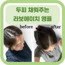[두피 엠플] 라보에이치 헤어라인 앰플 솔직후기/ 9일 동안 써본 결과 / 두피앰플/ 탈모증상 완화...