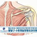 수원제일정형외과의원 | 수원 인계동 정형외과, 어깨 통증이 심할 때 의심하는 석회성 건염! 원인부터 치료까지.