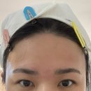 희헤어라인 이미지