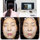 연합한의원 | 구안와사 한의원, 2년 포기한 70대 환자 세달 만에 회복한 사례