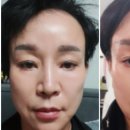 나르시피아