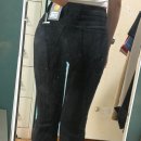 천변우하로L | [서울/홍대] 허벅지 지방흡입주사 2달차 리얼 후기 / 라인이 점점 자리를 잡아가요!