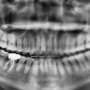 연세리버힐치과의원 이미지