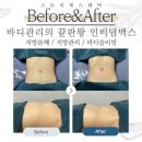 천안 피부관리 스토리에스테틱 작은얼굴경락 신불당 피부관리 찐후기